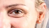 Riduri și realitate. Sunt ele semne ale îmbătrânirii sau ale unei vieți trăite intens?