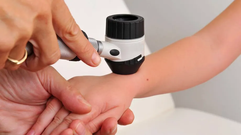Testări dermatologice gratuite în luna iunie, în trei județe din România. În ce date au loc