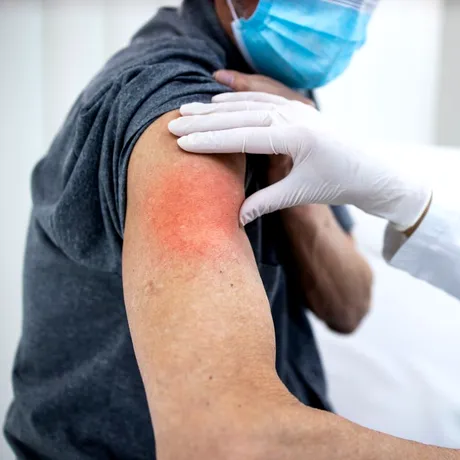 Efectele vaccinului COVID pe termen lung – sunt motive de îngrijorare?