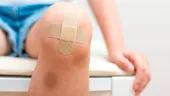 Vânătăile inexplicabile la copii: când ar trebui să te îngrijoreze că ar indica o problemă de sănătate