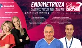 Endometrioza: cum se depistează corect. Medic: Pacientele pot avea „burtă de endometrioză” – CSID.RO Live