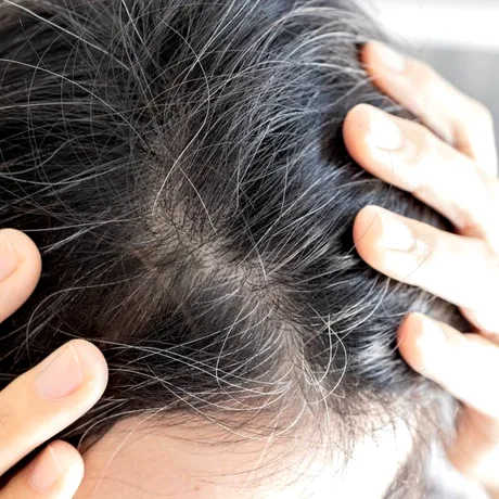 Albirea părului este reversibilă! Ce trebuie să faci și la ce să fii atent, de fapt