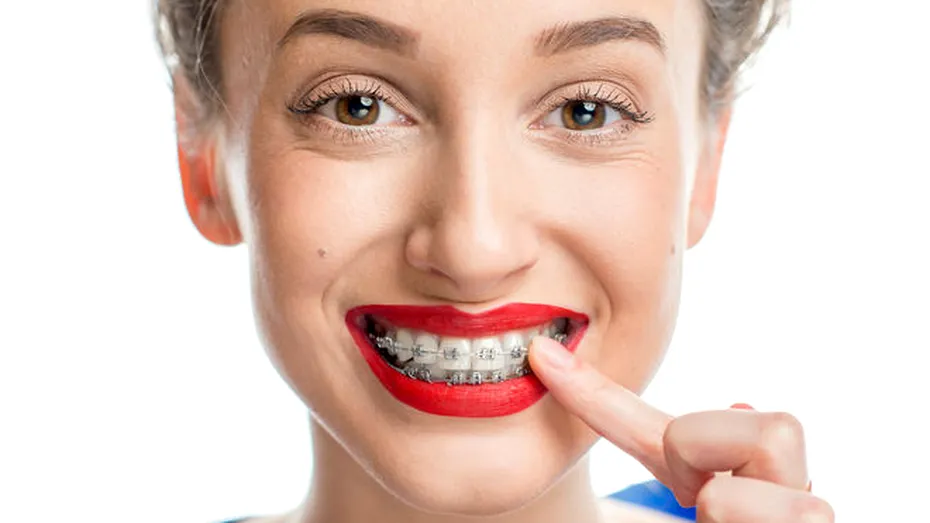 Primele zile cu aparat dentar: cum depăşim orice disconfort