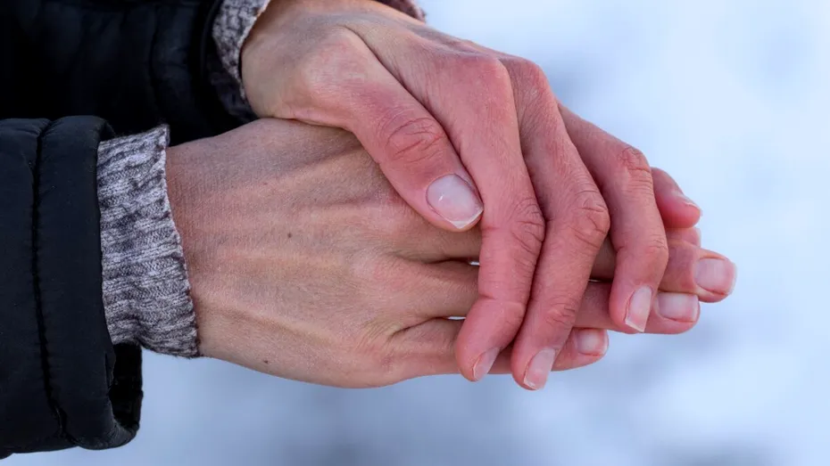 Ce este alergia la frig și cum se manifestă