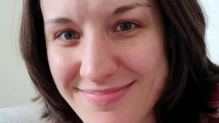 Ce a pățit femeia din imagine, după ce a mâncat morcovi în fiecare zi. Cum s-a transformat pielea ei