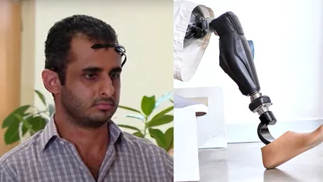 PREMIERĂ. Cercetătorii de la Universitatea Politehnica din București au creat un picior bionic controlat cu puterea gândului