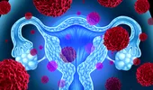 După analizarea a 15.000 de femei s-a descoperit cât de periculoase pot fi ciclurile menstruale neregulate