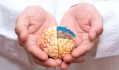 Analize care dezvăluie dacă ești la risc să faci accident vascular cerebral