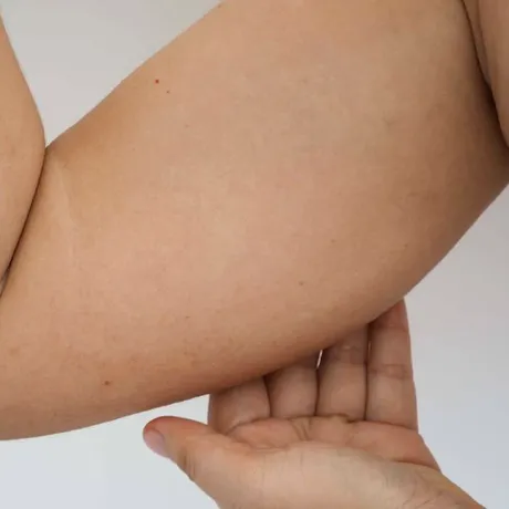 Fructul exotic care acționează ca un „arzător natural de grăsimi”