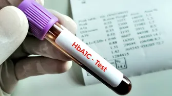 De ce poate crește hemoglobina glicată (HbA1c)? Glicemia ridicată nu este singura explicație