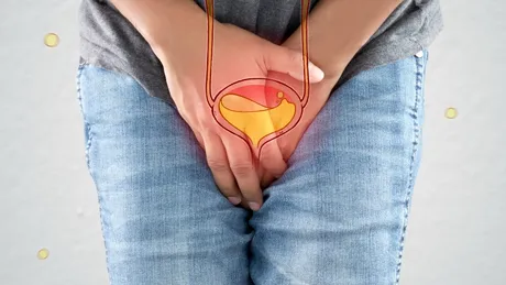 Vezica hiperactivă: cauze, simptome, tratament