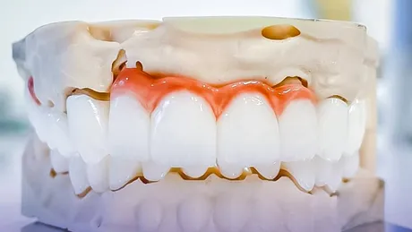 (P) Estetică fără compromis: De ce implantul dentar e cea mai naturală soluție