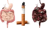 Fumatul – cum îți distruge stomacul și ficatul. Fiecare țigară îți răpește 11 minute din viață