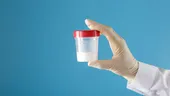 Poate o spermogramă realizată acasă să indice fertilitatea masculină?