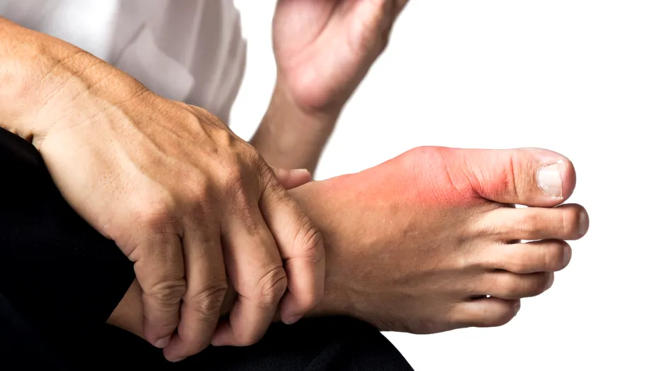 Cum poți să previi guta, boala articulațiilor dureroase. Ce alimente trebuie să consumi cât mai rar