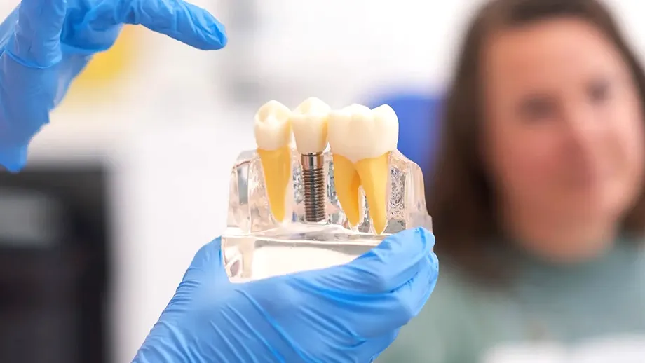 (P) Cum afecteaza diabetul succesul implanturilor dentare