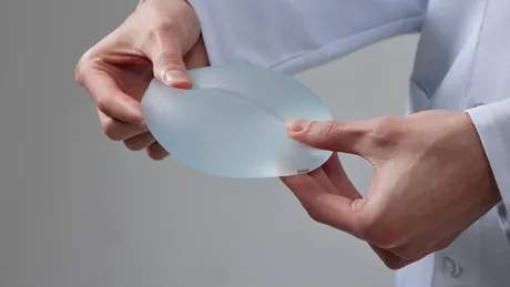 Ce sunt sânii tuberoși și cum poți corecta această anomalie