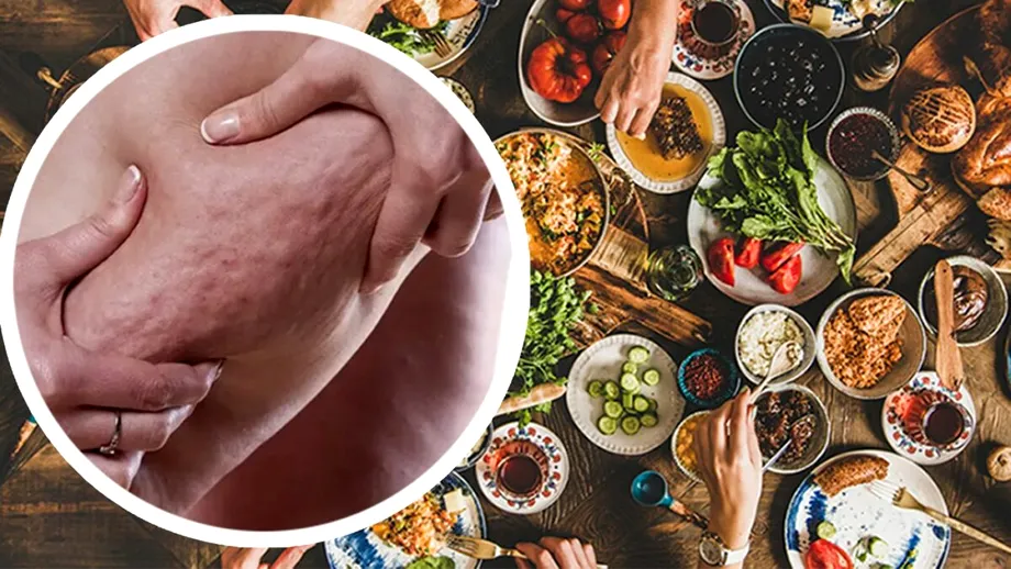 Cele 5 alimente din cauza cărora apare celulita. Ferește-te de ele și vei avea o piele fină și sănătoasă!