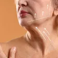 Liftingul cervical: când gâtul are nevoie de chirurgie și nu de încă un tratament estetic