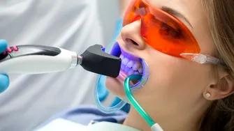 Albirea profesională a dinților – de câte ori se poate face într-un an?