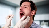 Nu au fumat niciodată, dar au făcut cancer oral. Semnalele de alarmă pe care tinerii le ignoră