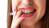 De ce se îngălbenesc dinții și care sunt cele mai eficiente remedii pentru dinți galbeni
