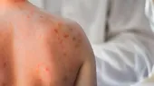Pielea care „ține minte” stresul: cum se vede anxietatea pe ten