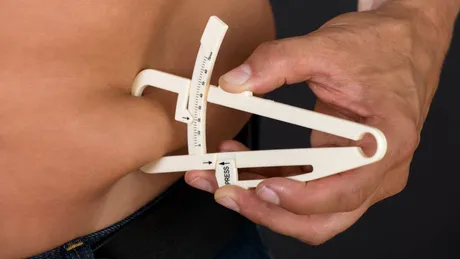 Cea mai frecventă greșeală după chirurgia bariatrică nu are legătură cu operația