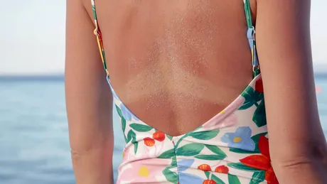 Dr. Andreea Domnițeanu, medic dermatolog: Nu există bronz natural și sănătos atunci când vorbim despre expunerea la soare