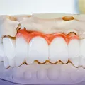 (P) Dinții sensibili la frig? Află cum tratamentele de desensibilizare dentară îți aduc confort