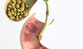 5 semne că ai probleme cu colecistul. Alimente care declanșează criza de fiere