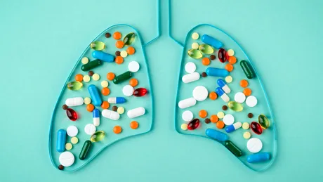 Pneumonia: cum se manifestă și când sunt necesare antibioticele