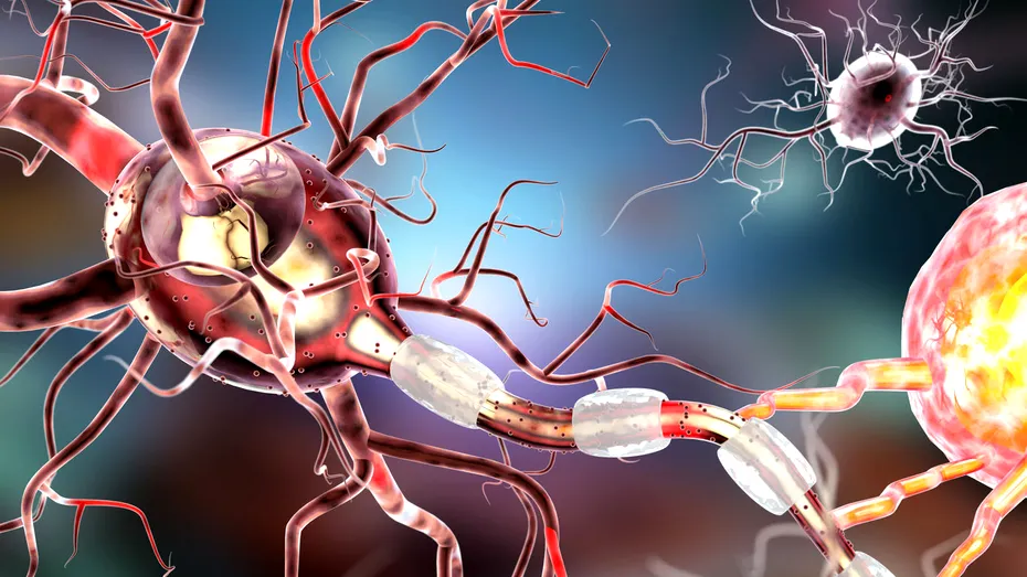 Epilepsia: simptome, tratament