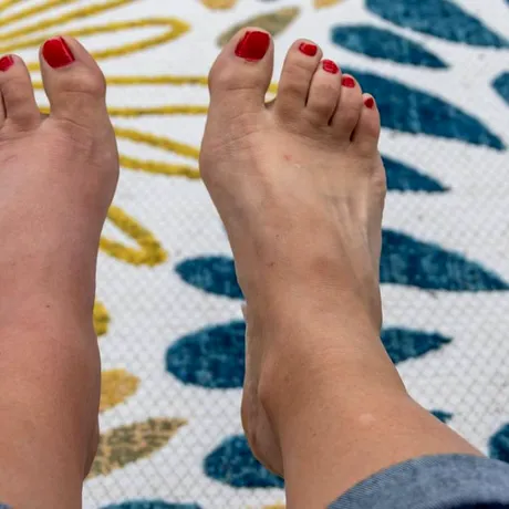 Probleme ale picioarelor care ar putea indica stări grave de sănătate. La ce să fii atent