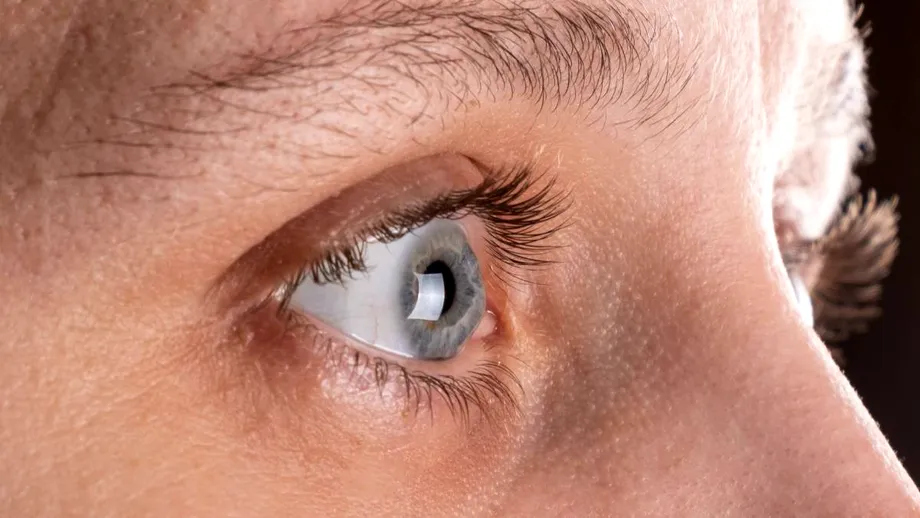 Semnul subtil din sprâncene care anunță o carență