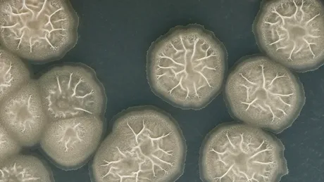 A fost la pas de moarte după ce a făcut baie în mare! Ce a pățit femeia din cauza unei tăieturi la picior