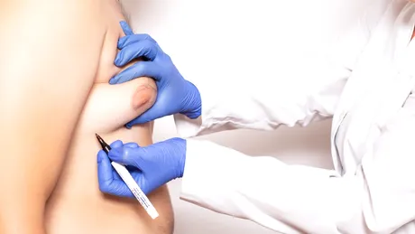 Și bărbații pot face cancer de sân. Care sunt simptomele și factorii de risc