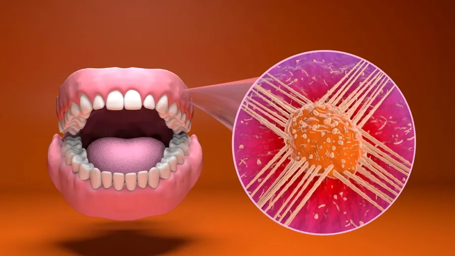 Dieta pentru prevenirea cancerului oral. Cum să te protejezi prin alimentație