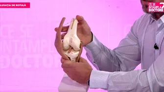 Luxația de rotulă: cauze, simptome și investigații esențiale