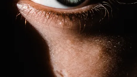 Un nou simptom COVID-19: apare în jurul ochilor. Cum se manifestă infecția când virusul ajunge în ochi