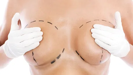 Ai avut parte de un implant mamar PIP? Află cum poţi obţine 3.000 de euro despăgubire