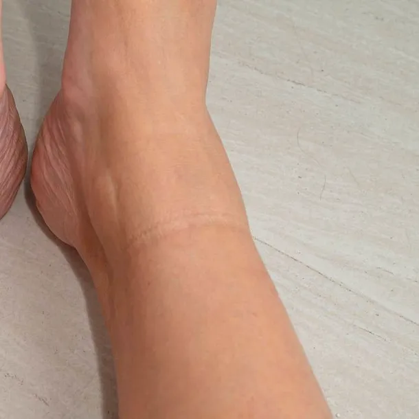 Dacă ai această linie pe picior suferi de boli cardiovasculare. Semne care trec neobservate, dar indică probleme serioase de sănătate