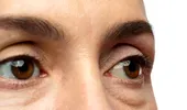 Ochi umflați: când este o problemă minoră și când trebuie să mergi la medic