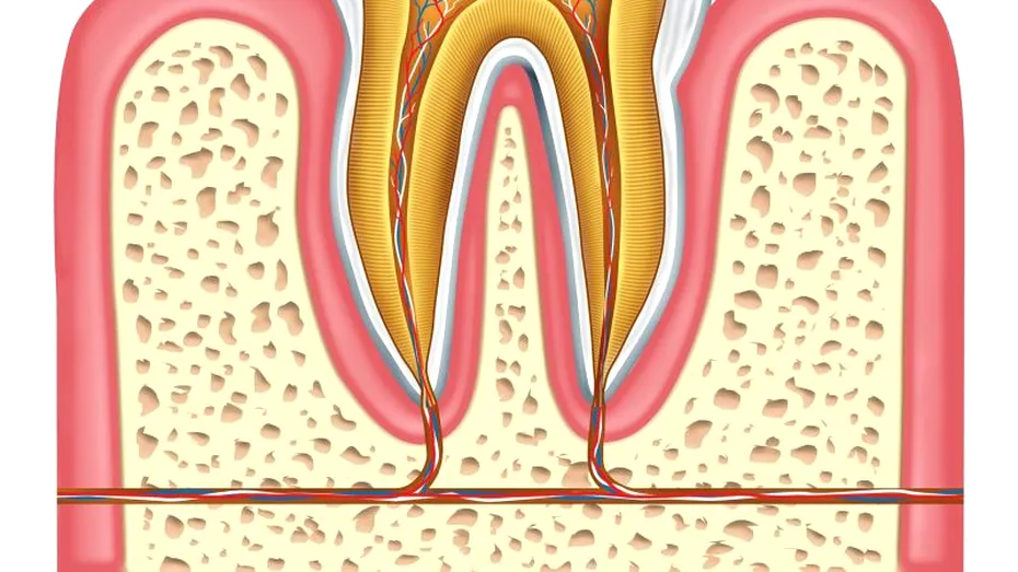 Eroziunea smaltului dentar: cauze, simptome, metode de prevenire si tratament