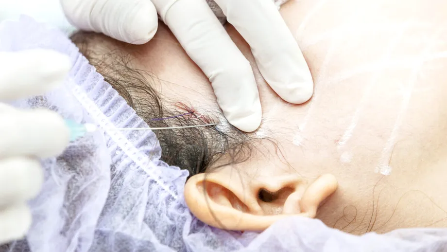 Colegiul Medicilor investighează medicul estetician din București, după ce o pacientă venită pentru lifting a ajuns în comă și a murit / VIDEO