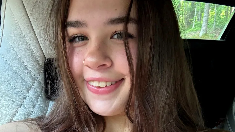 Ce a pățit tânăra din imagine, după ce a fumat 