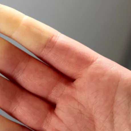 Probleme de sănătate cu care te poți confrunta dacă îți este permanent frig sau ai mâinile reci