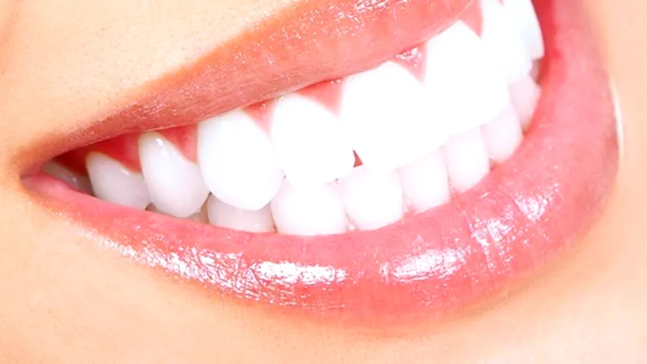 Faţete dentare, de ultimă generaţie. Se aplică direct pe dinte, nu mai necesită şlefuire!