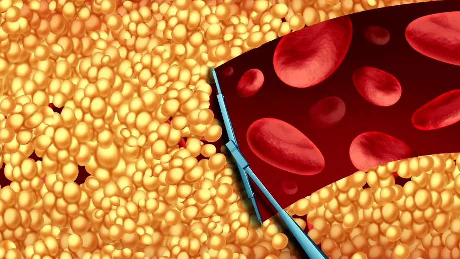 Ce să mănânci atunci când ai colesterolul mărit? Alimentul pe care îl poți consuma chiar și la conservă