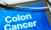 Dr. Ştefan Tucă: când se operează cancerul colorectal